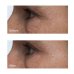 Perricone MD Cold Plasma Plus+ Advanced Eye Cream Contorno Occhi 15ml