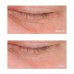 Perricone MD Cold Plasma Plus+ Advanced Eye Cream Contorno Occhi 15ml