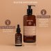 Dry Dandruff Apivita 500ml Ecopack