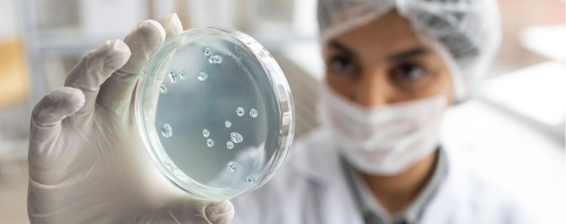 Akkermansia Muciniphila, il batterio alleato della salute