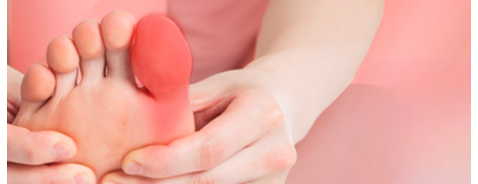 Come curare un'infiammazione all'alluce