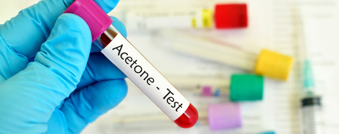 Anche gli adulti possono soffrire di acetone?