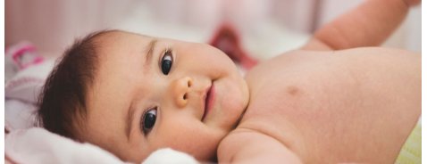Cos'è la crosta lattea nel neonato e come si cura
