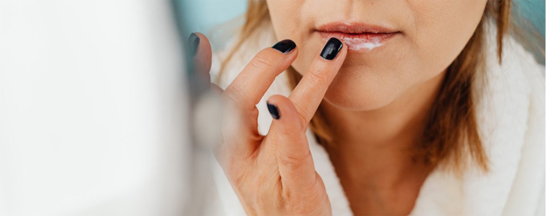 Come curare le labbra screpolate: tutti i rimedi più efficaci