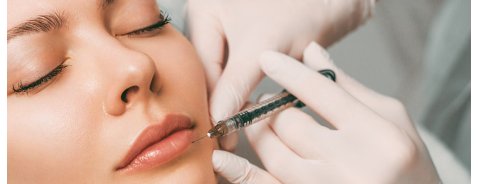 Filler per le labbra: tutto quello che c'è da sapere Filler per le labbra: tutto quello che c'è da sapere