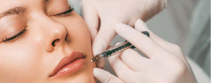 Filler per le labbra: tutto quello che c'è da sapere