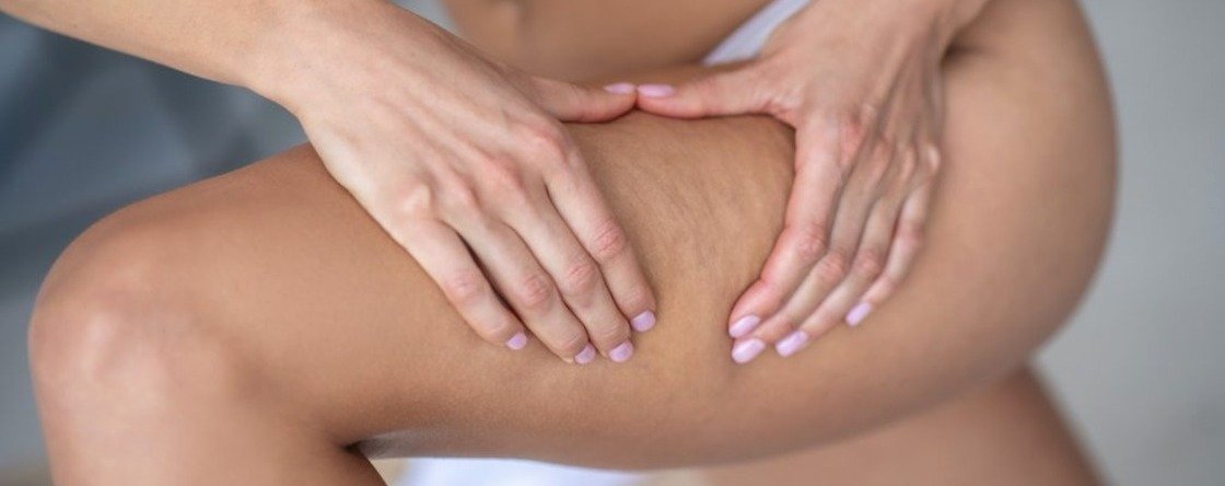 Olio anti cellulite: qual è il migliore in commercio?