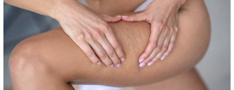 Olio anti cellulite: qual è il migliore in commercio?