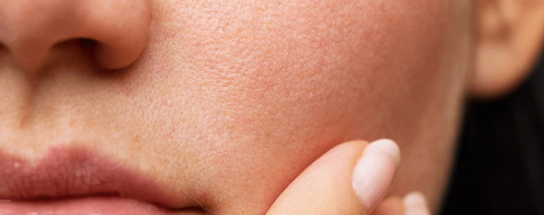 Come si fa a capire il tipo di pelle?