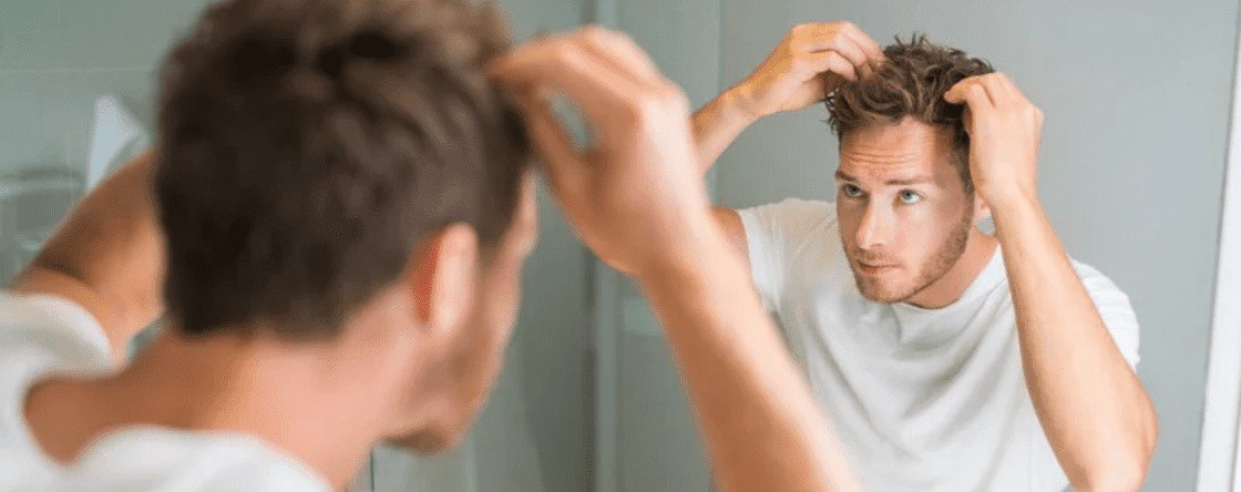 Cosa causa la perdita di capelli nell'uomo e come bloccarla