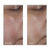 Perricone MD No Rinse Intensive Pore Minimizing Toner 118 ml