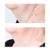 Perricone MD Cold Plasma Plus+ Neck Trattamento Collo e Sottomento 59ml