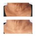 Perricone MD Cold Plasma Plus+ Neck Trattamento Collo e Sottomento 59ml
