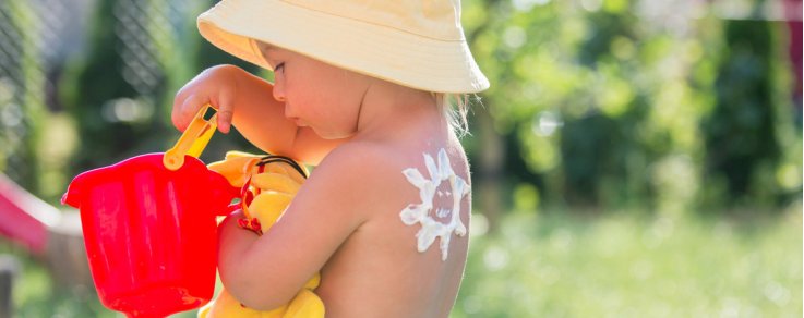 Come curare l'eritema solare nei bambini?