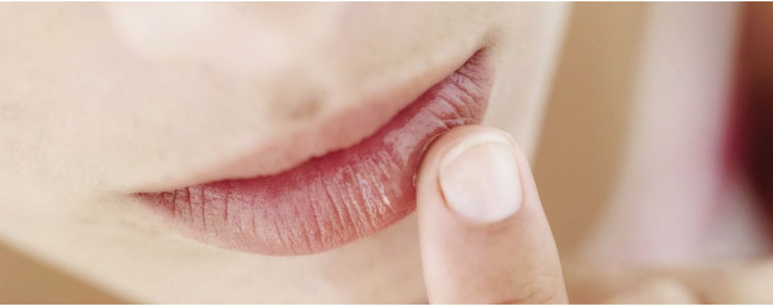 Come prenderti cura delle tue labbra
