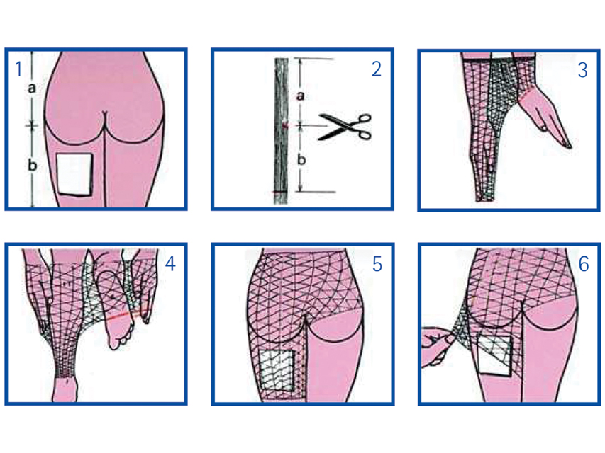 Image of RETE TUBOLARE ELASTICA CALIB 7033